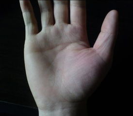 掌纹概论：先天生成与后天演变的辨证关系