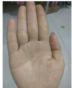 2.4 手指横纹占主导、 竖纹稀缺——所谓“劳碌命”