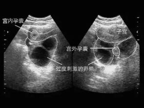1. 试纸说NO，但人家还不来？