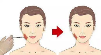 三、 现代医学美容技术对川字纹的干预手段