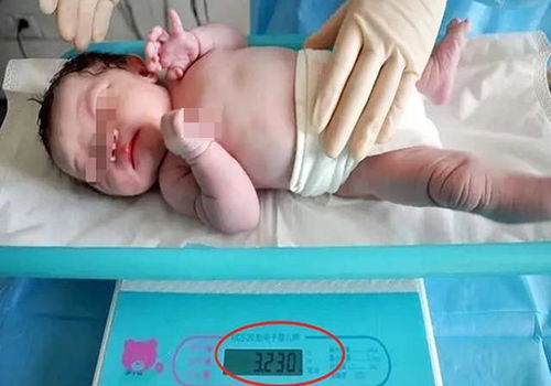 孕期营养与胎儿体重：一个复杂的动态平衡