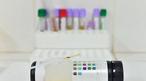 第四章: 除了时间段和测试剂…还有哪些呢？