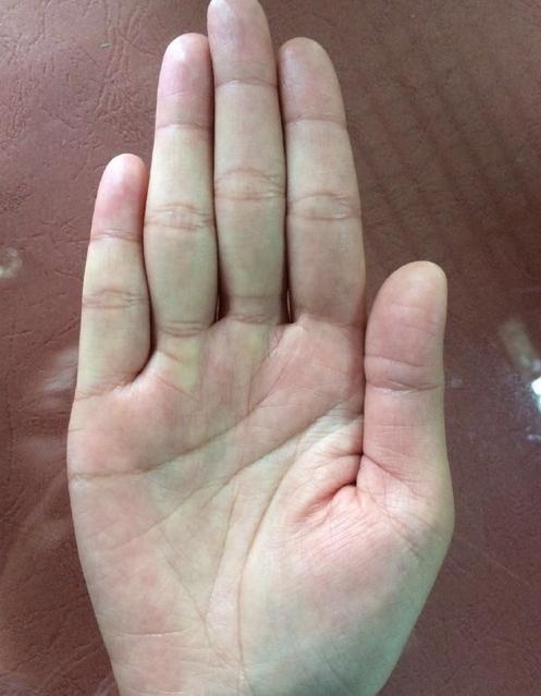 掌中长痣：吉祥寓意与智慧机敏的隐喻
