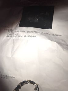 月经推迟5天正常吗？