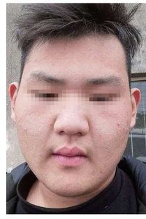 面型呈“风”字形之破坏潜嫩