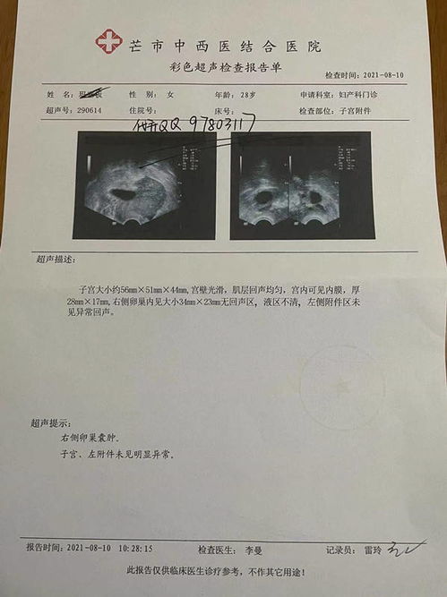 孕期检查的十分沉关键性