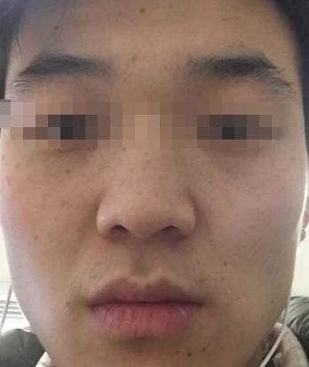 一、 丰厚宽大的鼻子与过度的经济驱动