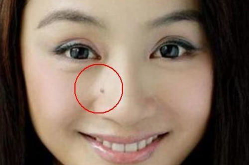 三、 鼻根长痣与财运及职业发展的关联