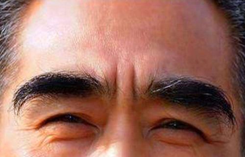 2.1 毛发生长的生物学基础及其误区