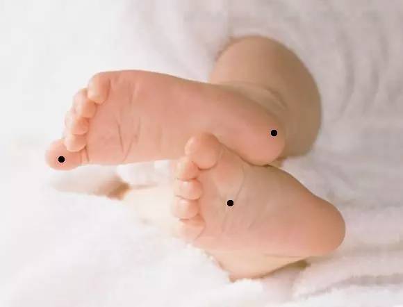 ：脚底有痣现象的文化隐喻与现实考辨