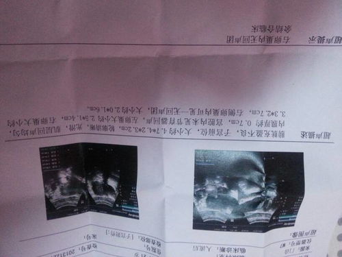 三、 医学风险与心理影响之交叉分析