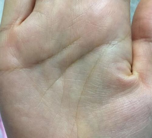 繁杂纹理的名词化阐释