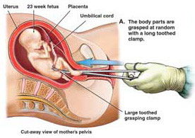 健康风险与后代出生质量