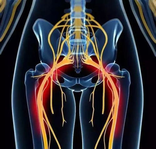 臀部及骶骨区域胎记：富贵命格与社会认可度