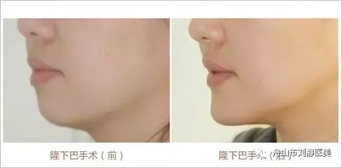 下巴与晚年生活及子孙运势的关系