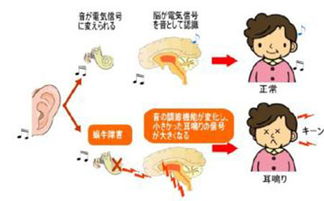 耳鸣现象与吉凶预兆之间有何关联？