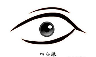 下三白眼的定义与成因