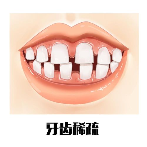 多重负面影响：不容忽视的功能与心理层面问题