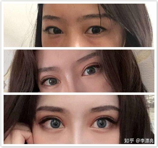 割双眼皮会影响我的面相和风水吗？