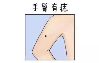 8．胸部中心（乳房）之痣