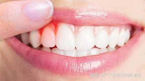 关于判断牙齿脱落之征兆的学术阐释