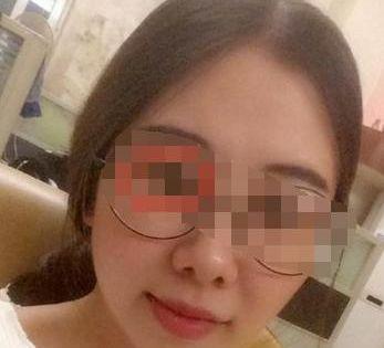 鼻正嘴大者