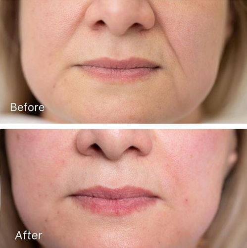 震惊！脸上这条纹路竟决定你的人生？99%的人都不知道的真相！