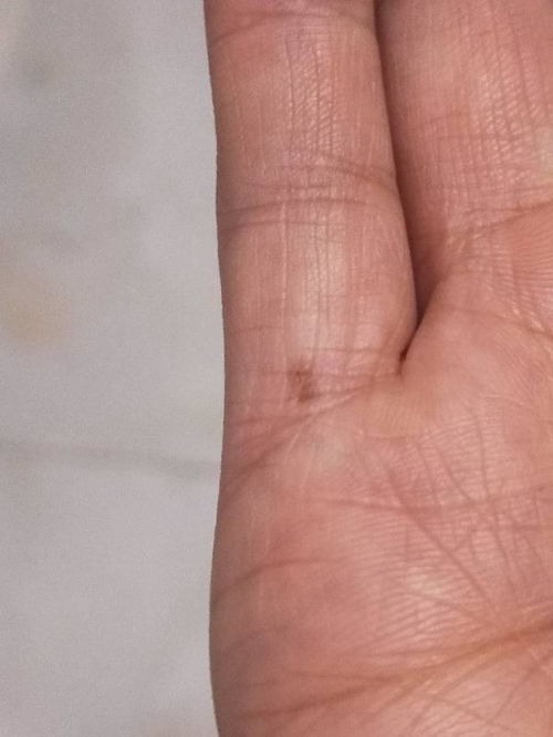 ：关于体相符号学中色素沉着的命运隐喻