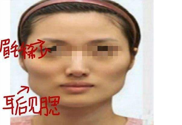 耳部特征——薄细小耳与学习坚持度之关系