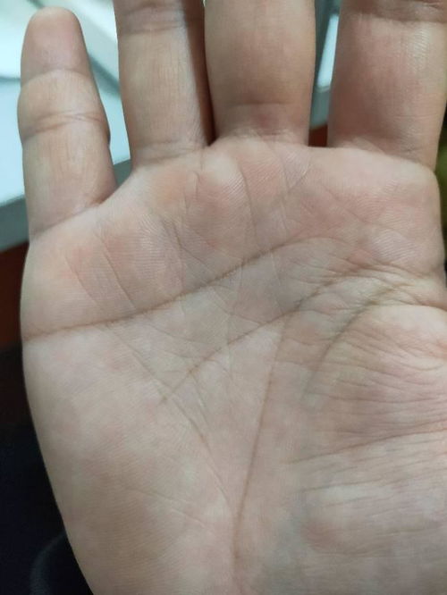 智慧线起点距离生命线远近——理性程度之标尺