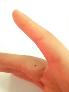 五、 临床管理建议：观察、干预与防范策略