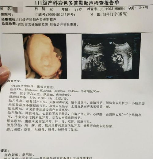 震惊！胎儿位置暗藏惊天密码