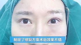 眼皮下垂对家居风水有影响吗？