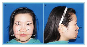 脸上肉微颤或脸发红，是预示着吉凶的征兆吗？