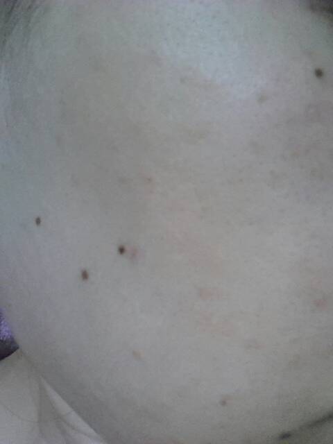 色素沉淀的生理机制