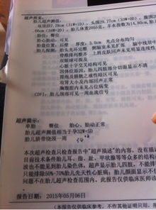 第一章 周 岆 与 虚 岆 的 界 定 与 运 算 方法（第二节）