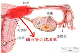 四、 怎么去医院检查（随便挑一个就行）
