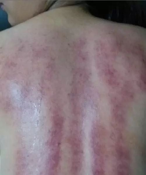 梦见别人刮腋毛是什么预兆？有什么特殊含义吗？