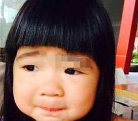 张婷的面相有哪些特点？如何进行详细的面相分析？