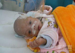 早产了这是不是意味着我其实有早产征兆没察觉？