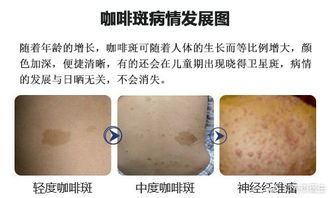 二、  手术创伤与器质性损伤风险