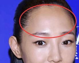 圆脑袋的诅咒与祝福