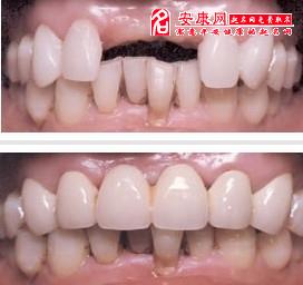 梦见掉牙是什么不祥的征兆？