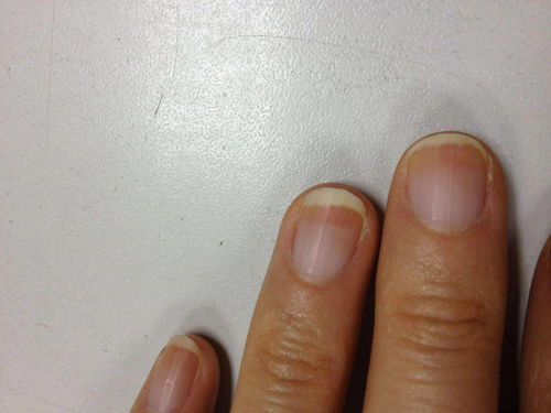 行为异常的表现形式