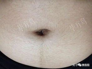 2.1 肚脐深度与智力关联的传统说法