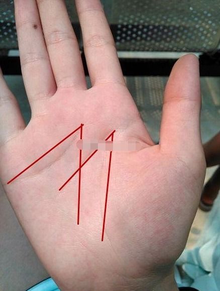 第一章：下巴圆润与基础运势的辩证关系