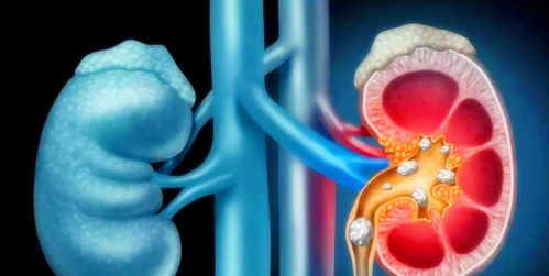 综合防范：多维度的健康管理策略