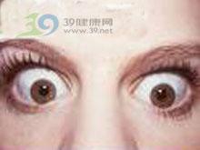 1) 炎性突眼：Graves病案例解析