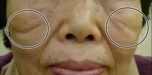 为什么印第安人脸上会有酒窝，这个独特的面部特征背后有什么传说故事？