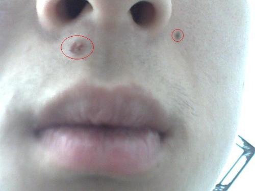 五、案例分析与佐证